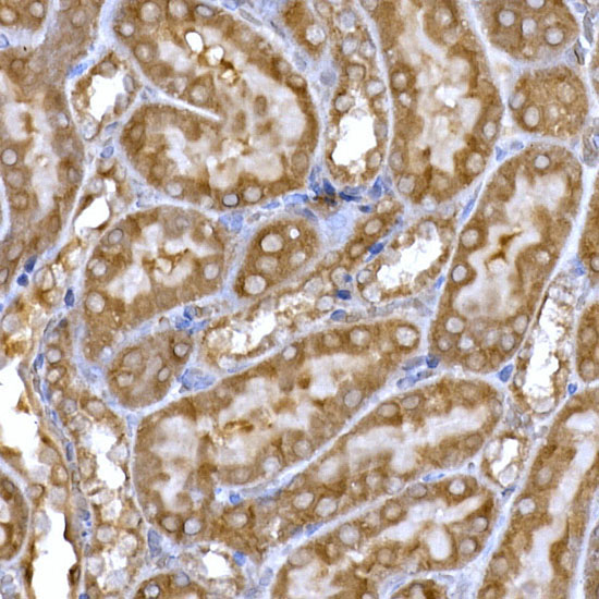 PPP1R3C Rabbit Polyclonal Antibody