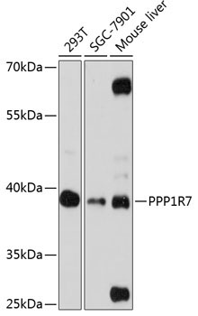 PPP1R7 Rabbit Polyclonal Antibody