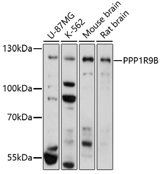 PPP1R9B Rabbit Polyclonal Antibody