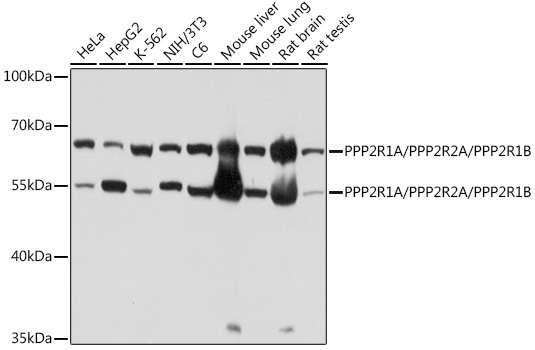 PPP2R1A/PPP2R2A/PPP2R1B Rabbit Polyclonal Antibody
