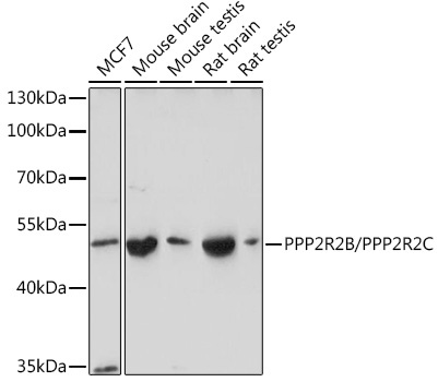 PPP2R2B/PPP2R2C Rabbit Polyclonal Antibody