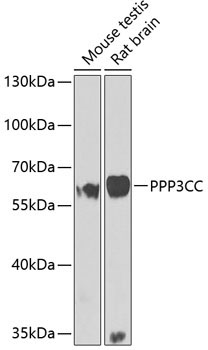 PPP3CC Rabbit Polyclonal Antibody