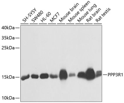 PPP3R1 Rabbit Polyclonal Antibody