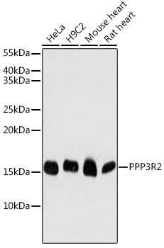 PPP3R2 Rabbit Polyclonal Antibody