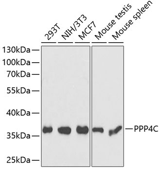 PPP4C Rabbit Polyclonal Antibody