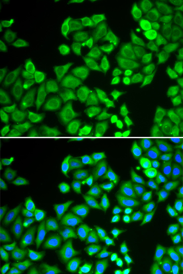 PPP4C Rabbit Polyclonal Antibody - Image 2
