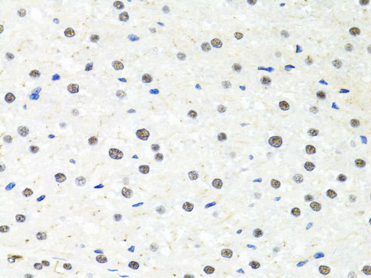 PPP4C Rabbit Polyclonal Antibody - Image 2