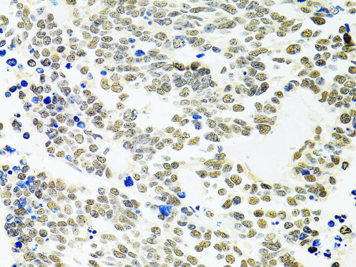 PPP4C Rabbit Polyclonal Antibody - Image 3