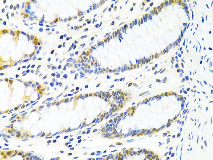 PPP4C Rabbit Polyclonal Antibody - Image 4