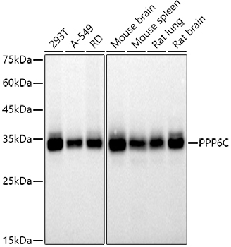 PPP6C Rabbit Monoclonal Antibody