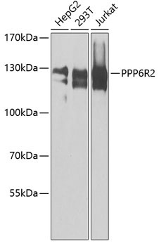 PPP6R2 Rabbit Polyclonal Antibody