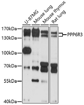 PPP6R3 Rabbit Polyclonal Antibody