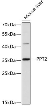 PPT2 Rabbit Polyclonal Antibody