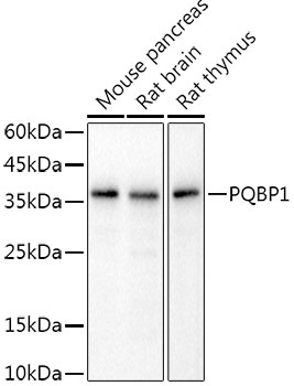 PQBP1 Rabbit Monoclonal Antibody