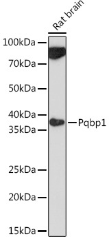 Pqbp1 Rabbit Polyclonal Antibody - Image 2