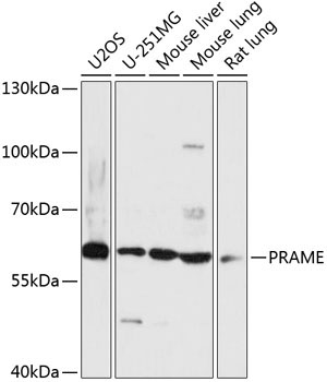 PRAME Rabbit Polyclonal Antibody
