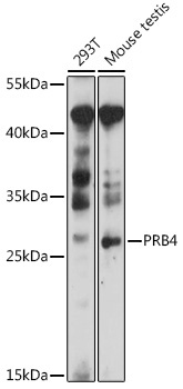PRB4 Rabbit Polyclonal Antibody