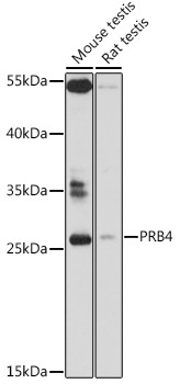PRB4 Rabbit Polyclonal Antibody