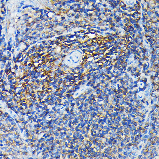 PRC1 Rabbit Polyclonal Antibody - Image 2