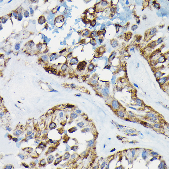 PRC1 Rabbit Polyclonal Antibody - Image 3