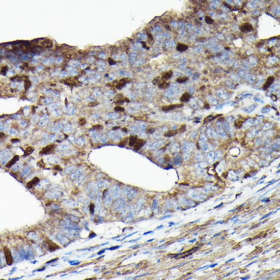 PRC1 Rabbit Polyclonal Antibody - Image 4
