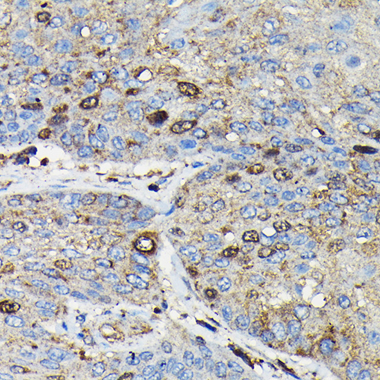 PRC1 Rabbit Polyclonal Antibody - Image 5