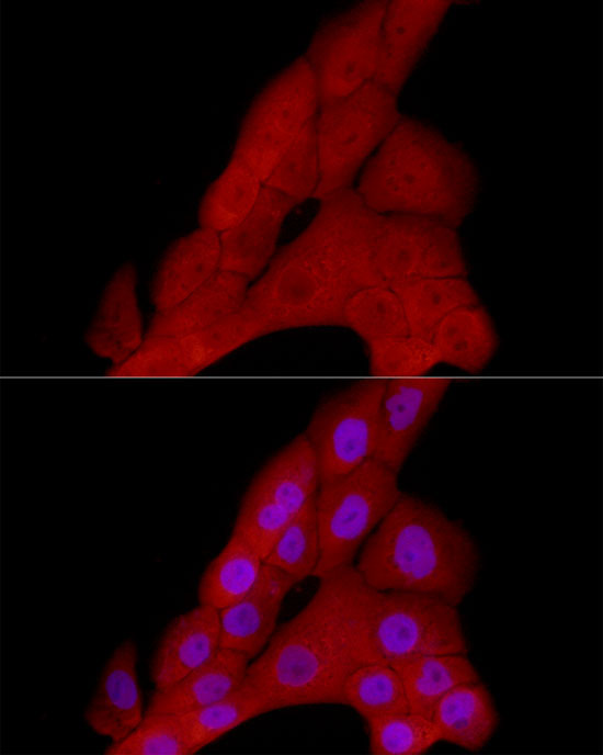 PRDM1 Rabbit Polyclonal Antibody - Image 2