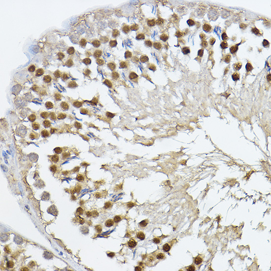 PRDM14 Rabbit Polyclonal Antibody - Image 3