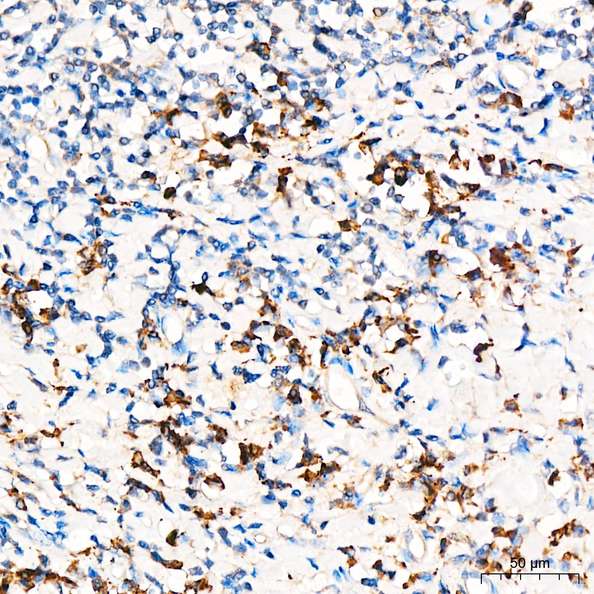 PRELID1 Rabbit Polyclonal Antibody