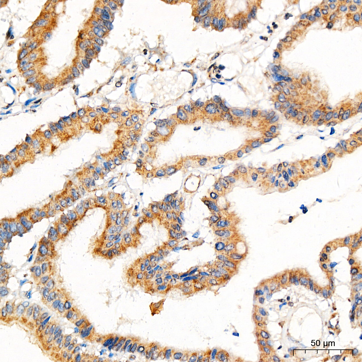 PRELID1 Rabbit Polyclonal Antibody - Image 2