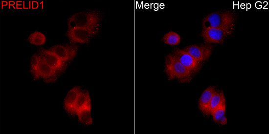PRELID1 Rabbit Polyclonal Antibody - Image 3
