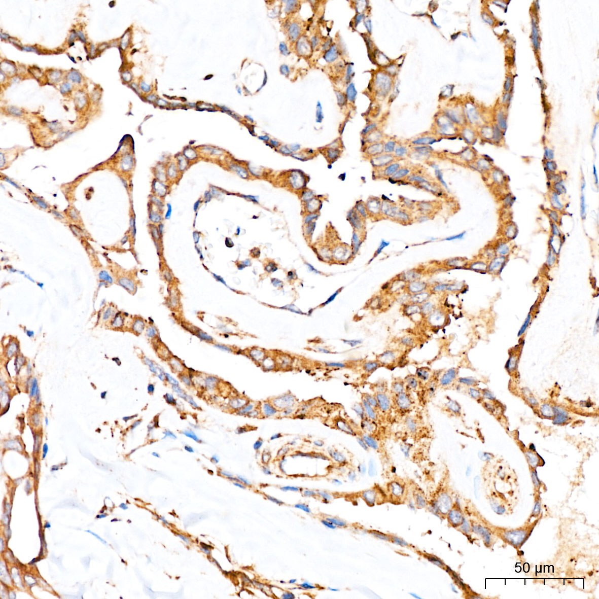 PRELID3A Rabbit Polyclonal Antibody