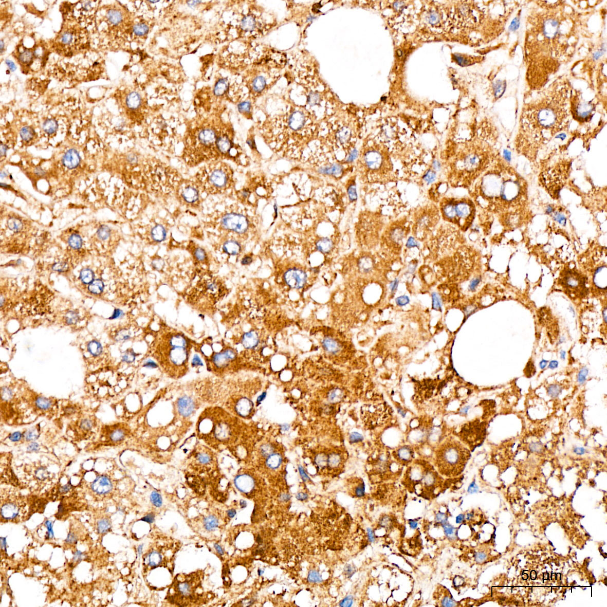 PRELID3A Rabbit Polyclonal Antibody - Image 2