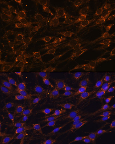 PREPL Rabbit Polyclonal Antibody - Image 2
