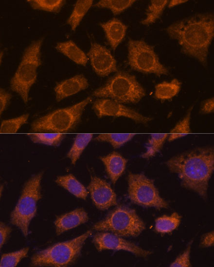 PREPL Rabbit Polyclonal Antibody - Image 3