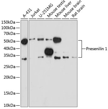 Presenilin 1 Rabbit Monoclonal Antibody