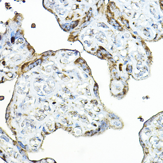 PRG2 Rabbit Polyclonal Antibody - Image 2