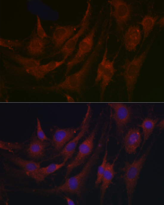 PRG2 Rabbit Polyclonal Antibody - Image 3