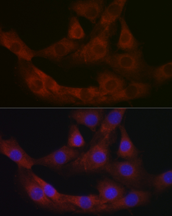 PRG2 Rabbit Polyclonal Antibody - Image 4