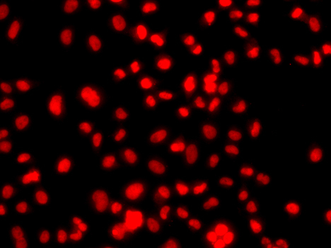 PRICKLE2 Rabbit Polyclonal Antibody - Image 2