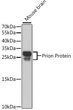 Prion Protein Rabbit Polyclonal Antibody