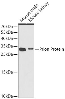 Prion Protein Rabbit Polyclonal Antibody