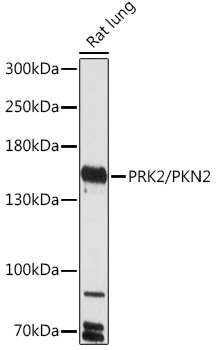PRK2/PKN2 Rabbit Polyclonal Antibody