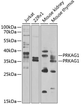 PRKAG1 Rabbit Polyclonal Antibody