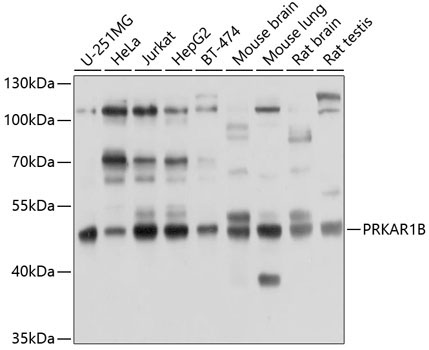 PRKAR1B Rabbit Polyclonal Antibody