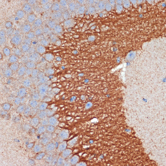 PRKAR2B Rabbit Monoclonal Antibody - Image 2