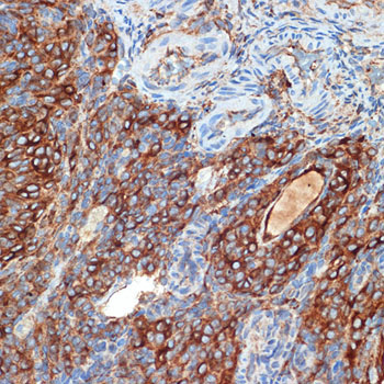 PRKAR2B Rabbit Monoclonal Antibody - Image 3