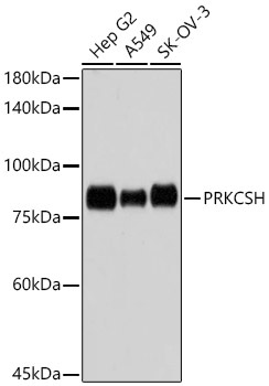 PRKCSH Rabbit Monoclonal Antibody
