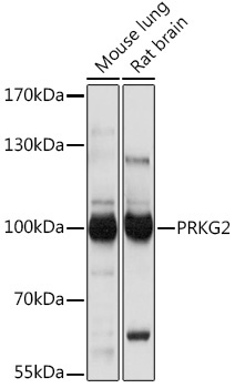 PRKG2 Rabbit Polyclonal Antibody