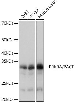 PRKRA/PACT Rabbit Monoclonal Antibody